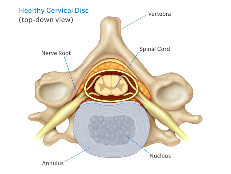 Intervertebral disc structure
