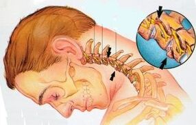 Cervical department