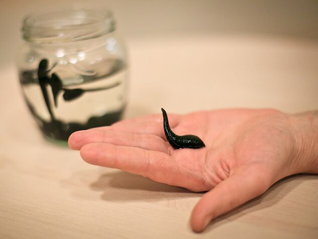 Application for the treatment of arthrosis of the knee joint